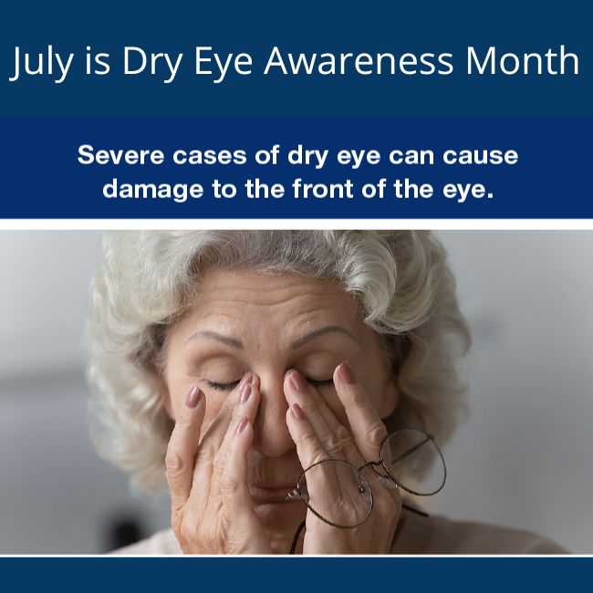 July is Dry Eye Awareness Month CBA Vision Rehabilitation Services